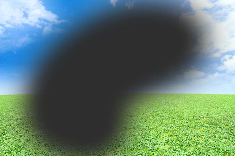 緑内障のイメージ写真